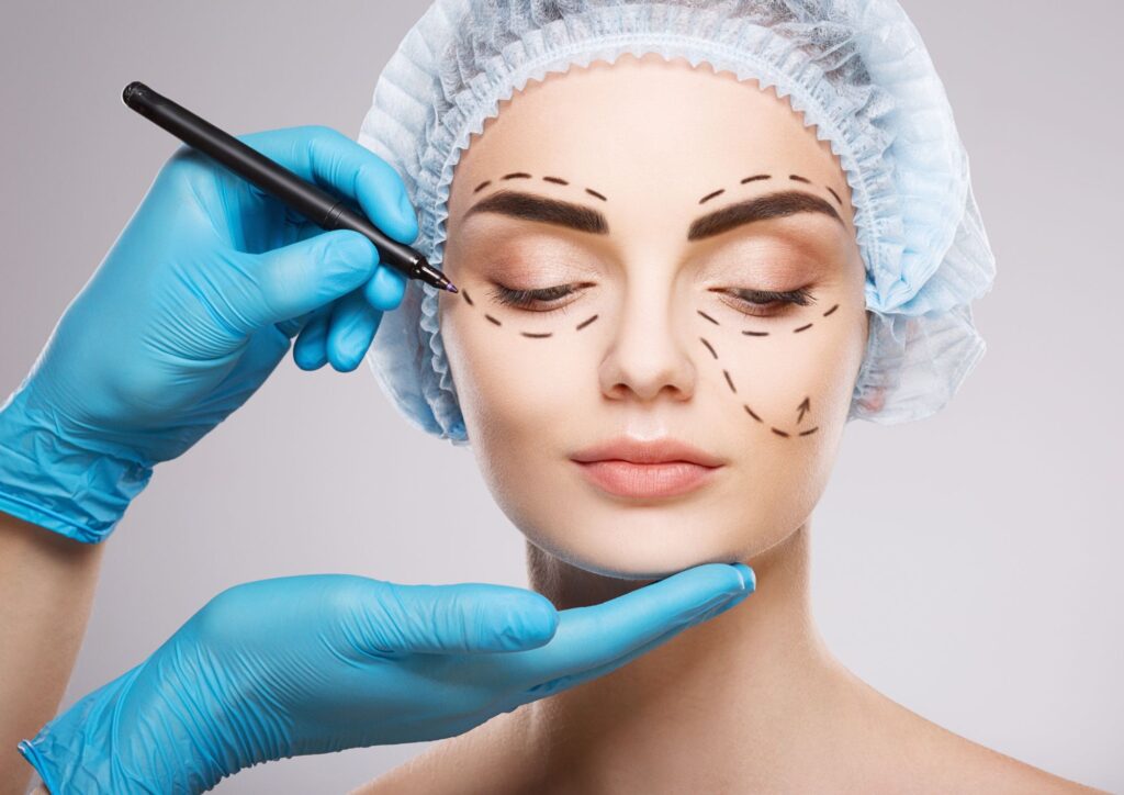 A person’s face being marked with dashed lines and arrows by a gloved professional, illustrating cosmetic surgery planning.